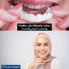 ⁦أسنان ابتسامة هوليوود⁩ - الصورة ⁦4⁩