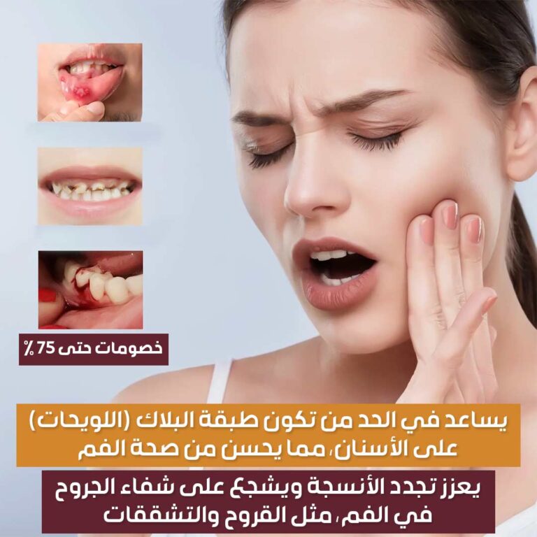 Mouth-Relief-Spray-2.jpg